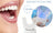 LED Teeth Whitening Kit with Gel and Light
